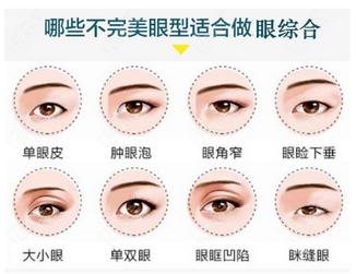 北京京民医院做眼部综合怎么样?医生个人简介/真实评价/地址介绍!