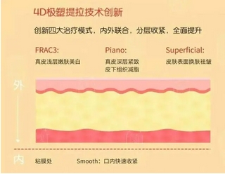 欧洲之星fotona4d能提眉吗?美白淡斑\淡化皱纹等都是作用!提眉有哪几种方法?