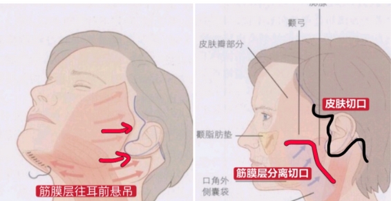 北京华韩拉皮手术价目表公开！看技术与口碑实力并存的医生有哪些？让 面部保持年轻化~