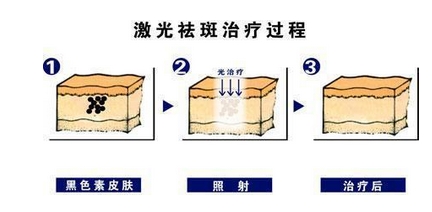 北京京民医院可以做激光祛斑吗？整形科口碑人气持续飙升！不看必后悔系类~