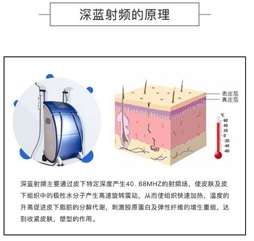 深蓝射频和热拉提区别有哪些?需要分别注意什么吗?抗衰新手必看攻略!