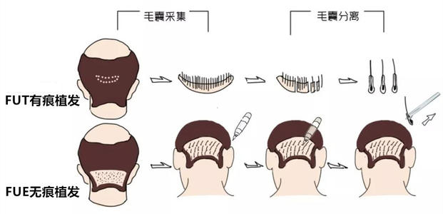南方医科大学南方医院樊哲祥怎么样？个人简介&发际线调整案例
