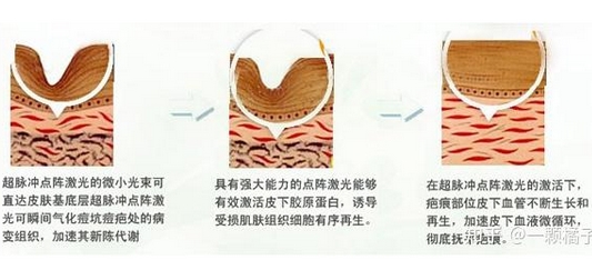北京丽都做点阵激光哪个医生好？王佳、姚玲、辛娟等技术分析！看看你喜欢的医生上榜了吗？