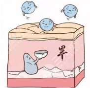 奥美定和玻尿酸区别？什么材质较为稳定？各特点解读，注射前必看~