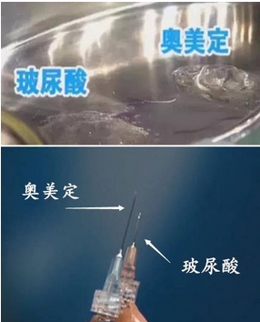 奥美定和玻尿酸区别？什么材质较为稳定？各特点解读，注射前必看~
