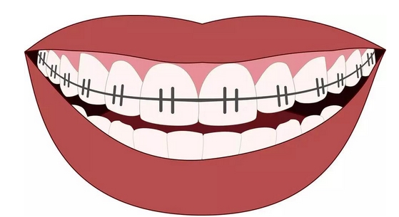 广州柏德口腔医院牙齿矫正价格怎么样？坐诊医生技术测评，牙齿矫正性价比高！