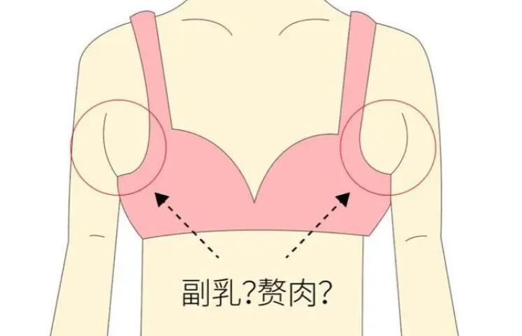 协和医院朱琳副乳手术技术如何？医生简介-近期案例-收费标准