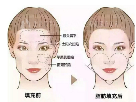 深圳蒳美迩医疗美容医院怎么样？口碑怎么样？医院地址及信息都有po上来哦！
