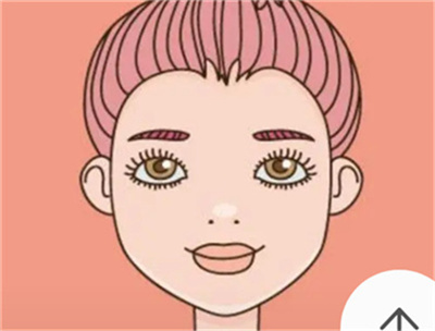 吴小蔚双眼皮修复案例真实分享，想要修复双眼皮的集美看过来！