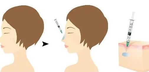 唐修俊贵州省人民医院隆鼻案例分享，医院及医生详情介绍