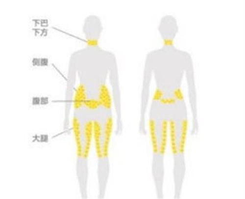 八大处吕倩雯吸脂价格怎么样？个人技术分析，附价目表参考！