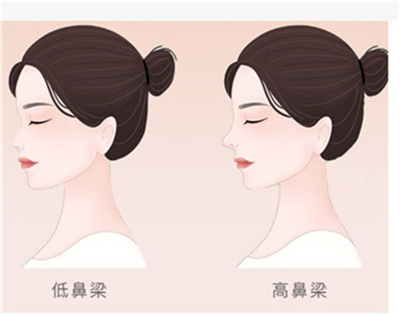 修复鼻专家王媛媛怎么样？医生个人资料介绍，戳进来参考！