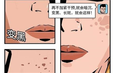 长沙星辰医美整形医院怎么样？医院在医美的口碑如何？内附激光祛斑案例！