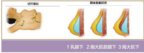广州海峡整形医院地址公开！医院及医生团队正规吗？本院资质简介，临床反馈好！
