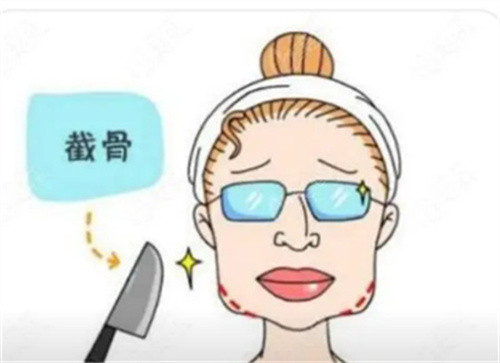 张辰做颅颌面怎么样？医生技术点评，案例分析