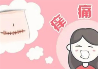 谭俊医生调节疤痕好吗？精湛技术蜕变容颜，案例分享