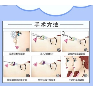 深圳美加美医疗美容怎么样价格表公开!医院实力|医生团队细节亲身体验!