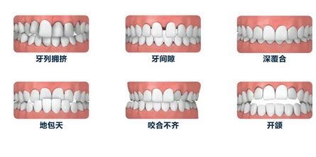 广州雅皓口腔是正规医院吗？正畸专家介绍，必备干货！反手就是点击收藏~