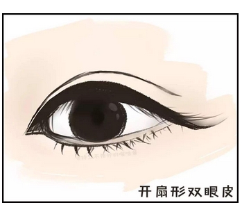 陈孟春双眼皮案例公布！院内主推医生案例过程全揭示！技术风格为你点评~