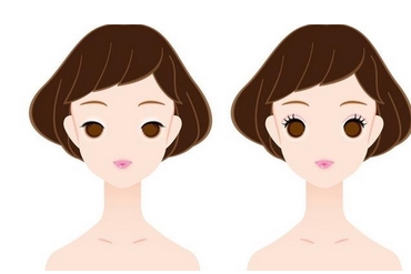 深圳美莱整形医院价格表公布!行业口碑和评价高吗?附眼部整形案例~