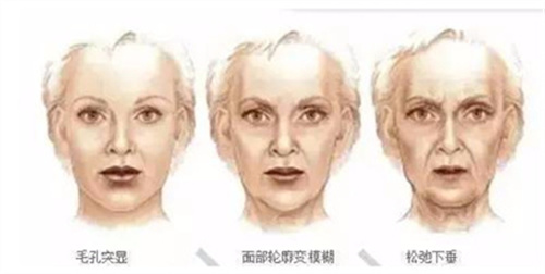 马桂娥去法令纹怎么样？个人点评，案例分享，附价格表参考！