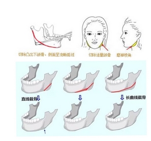 首尔丽格整形医院地址在哪里？众多医生实力评价，附医院热门项目科普！