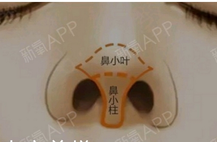 鼻小柱抬高是怎么做的？角度抬高和延长区别~鼻腔看上去坚挺美观，充满立体感~
