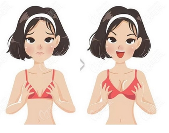 做胸部整形手术痛吗？术前术后分别注意什么？|乳晕也包含在内！
