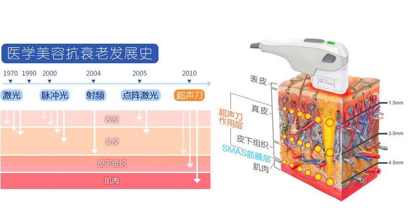 做超声刀的好处和坏处有哪些？会损伤面部神经吗？