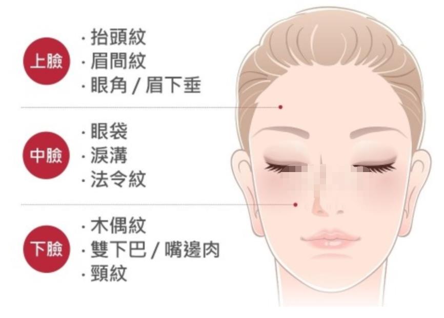 小拉皮手术价格一览表公开了！精选问答来袭~