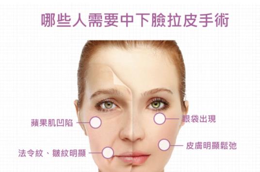 微创小拉皮切口在哪里？可以做哪些部位？3分钟了解~