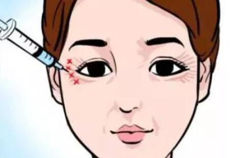乔星做眼周年轻化怎么样？网友亲身经历分享！