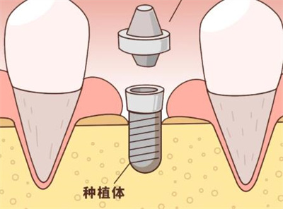 上海康态口腔种植牙怎么样？简介、专家、案例汇集在此！