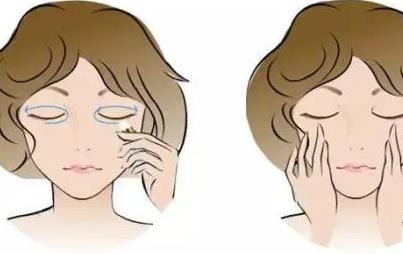 姜旭做眼袋切除怎么样？附案例前后对比图