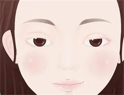 宋维铭双眼皮案例分享，带你了解双眼皮案例前后对比图 