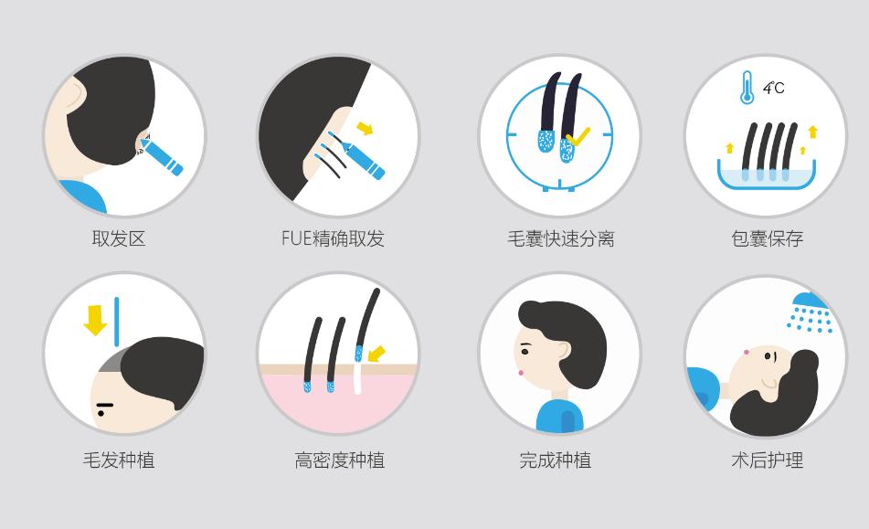 方帆调节脱发怎么样？坐诊医院基本资料介绍！植发后效果反馈！ 