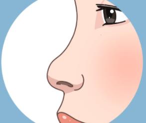 杜丽平的综合鼻整形怎么样？真人做隆鼻案例分享！价格表