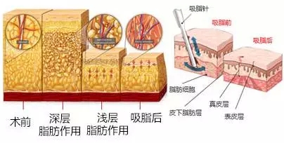 广州海峡整形中心怎么样？医院口碑_谢占军等简介_价格表