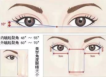 埋线双眼皮能保持多久？价格大概是多少？附注意事项~