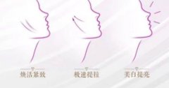5gmax极速提拉维持多久？作用原理、注意事项合集！抗衰揭秘~