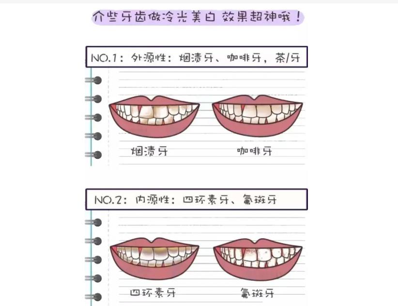 深圳牙科收费价目表2023刷新！附维护口腔健康科普