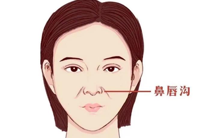 鼻唇沟整容手术多少钱？操作细节展示！附注意事项