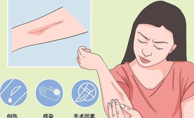 王法刚调节疤痕怎么样？网友日记分享：疤痕真的淡化了！