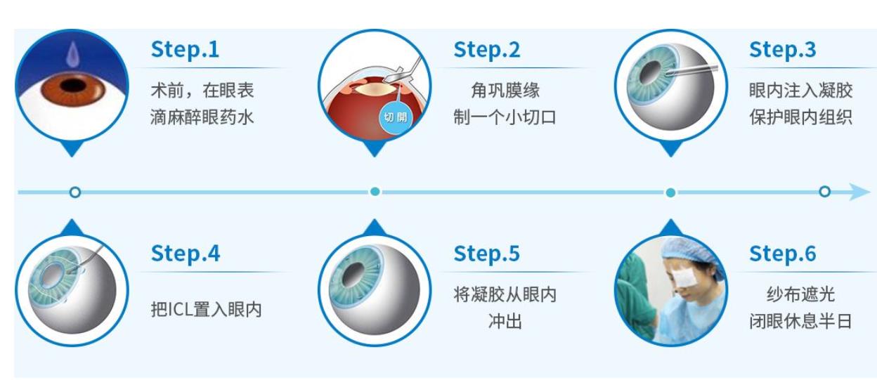 人工晶体植入多少钱？能用多少年？有危害吗？摘镜指南~