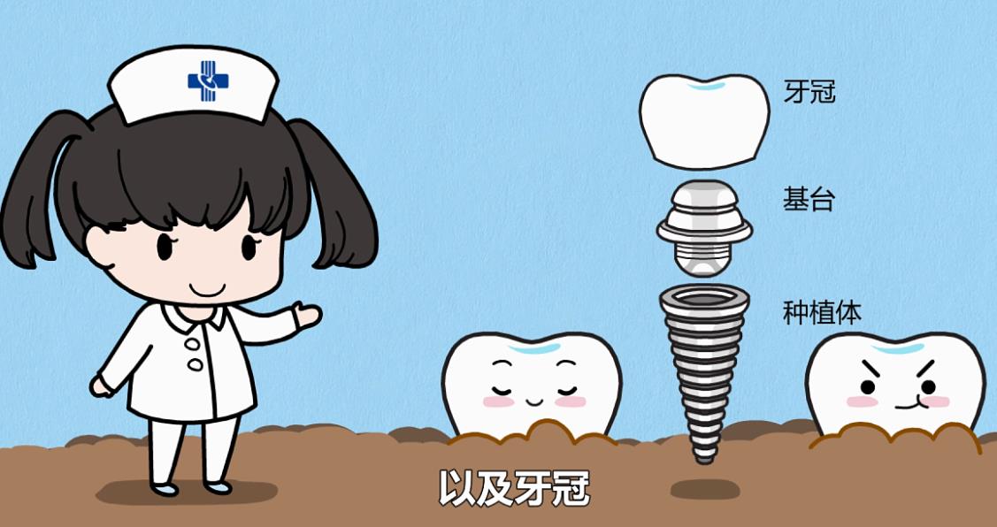 上海天使齿科种植牙价格表曝光!田杰和赵百良谁的技术好?手术对比照