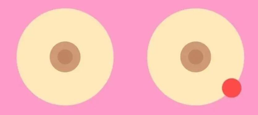 乳晕大怎么办？4个改良方式介绍！附乳晕漂红方法~