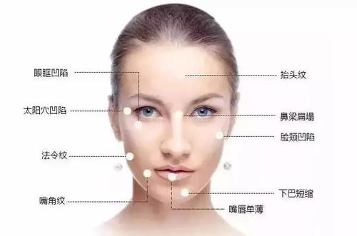 艾莉薇玻尿酸有几种型号？除皱＂轻奢＂玻尿酸介绍！