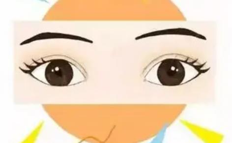 宋楠医生双眼皮案例介绍！医生的手术风格如何呢？对比照