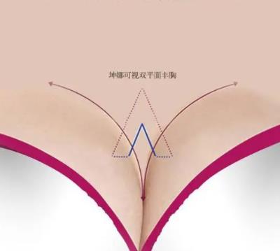 徐华隆胸怎么样？目前就职于哪家医院？胸部手术过程图