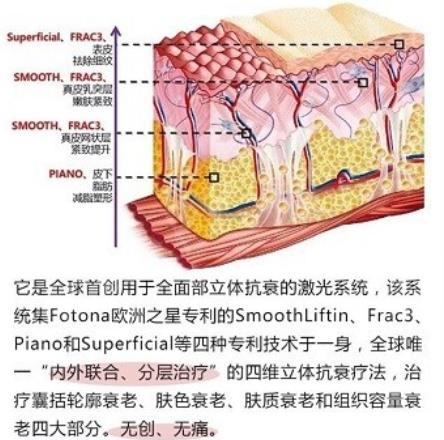 欧洲之星是做什么的？面部下垂、细纹等都可改良！初抗指南